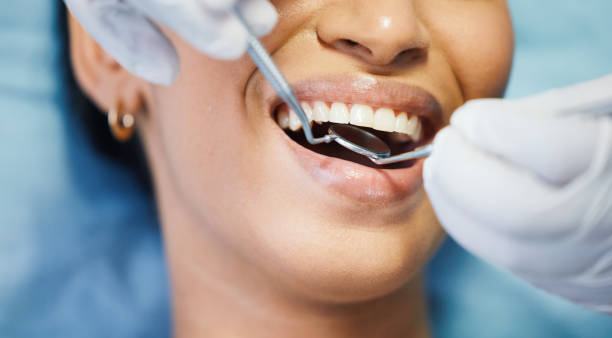 Best Emergency Dental Care for Broken or Chipped Teeth in Roseville, CA